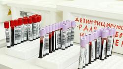 Белгородские медики впервые выявили у 259 жителей региона ВИЧ-инфекцию