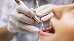 Вячеслав Гладков рассказал о результатах поездки мобильного стоматологического комплекса в ДНР